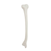 2031DDVL - RIGHT TIBIA  WITH DISTAL VALGUS DEFORMITY