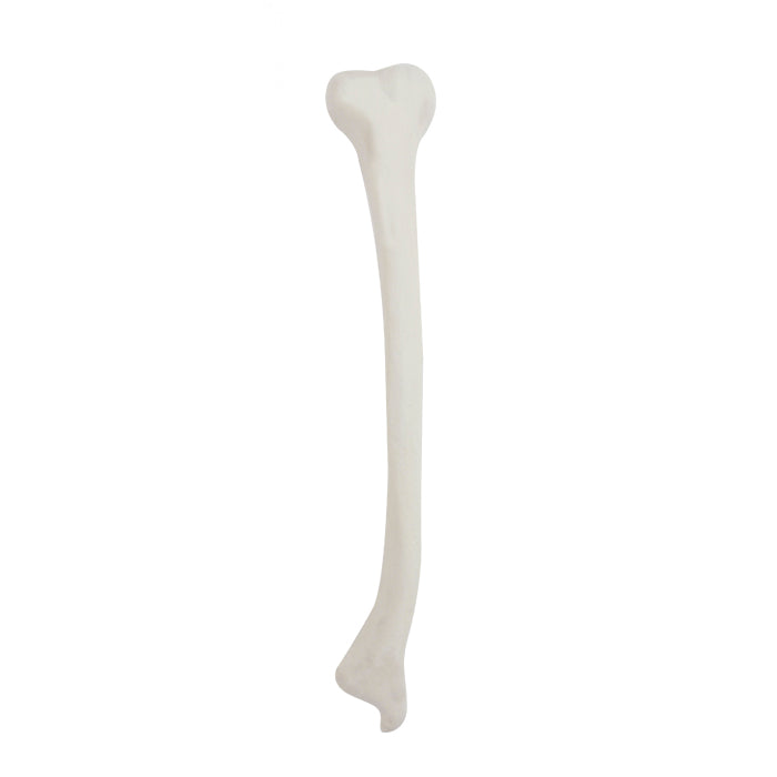 12435- RIGHT TIBIA  WITH DISTAL VALGUS DEFORMITY