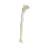 2031 PD - RIGHT TIBIA WITH SMALL PROXIMAL DEFORMITY