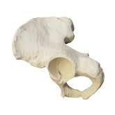 2032 - RIGHT PELVIS