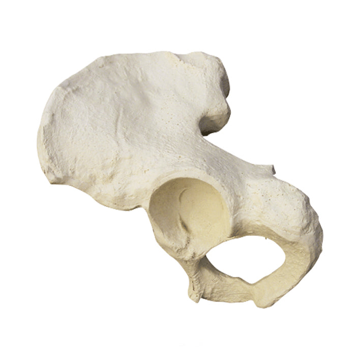 2032 - RIGHT PELVIS