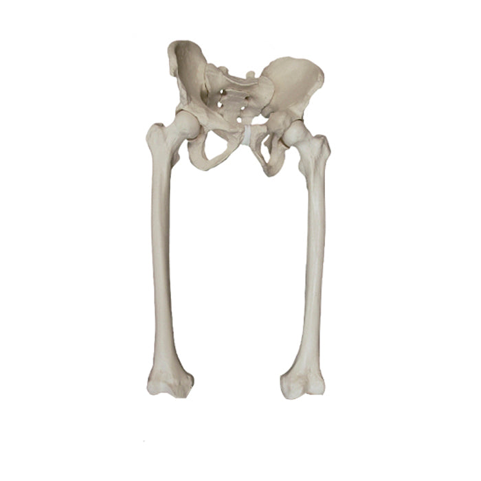 2042 - FULL HIP WITH RIGHT AND LEFT FEMUR