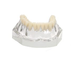 9570 – ACRYLIC MANDIBLE WITH TEETH AND 3 IMPLANTS