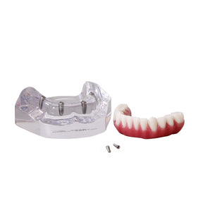 9568 – ACRYLIC MANDIBLE WITH PROTOCOL AND 4 IMPLANTS