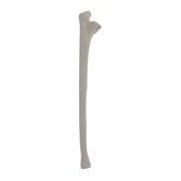 12332 - RADIOPAQUE RIGHT ULNA