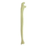 3010 - RIGHT ULNA