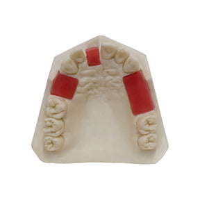 4200 - BASIC MODEL WITH SOME TEETH AND PARTIAL GUM