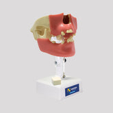 4005G - PREMOLAR MODEL WITH GUM