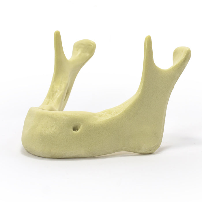 4010 R - RADIOPAQUE EDENTULOUS MANDIBLE