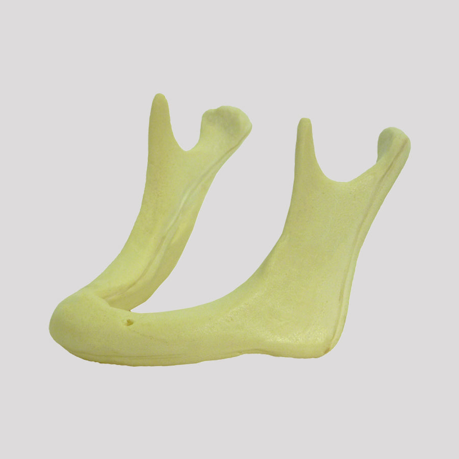 4010AT-01 - ATROPHIC EDENTULOUS MANDIBLE CLASS I (20MM)