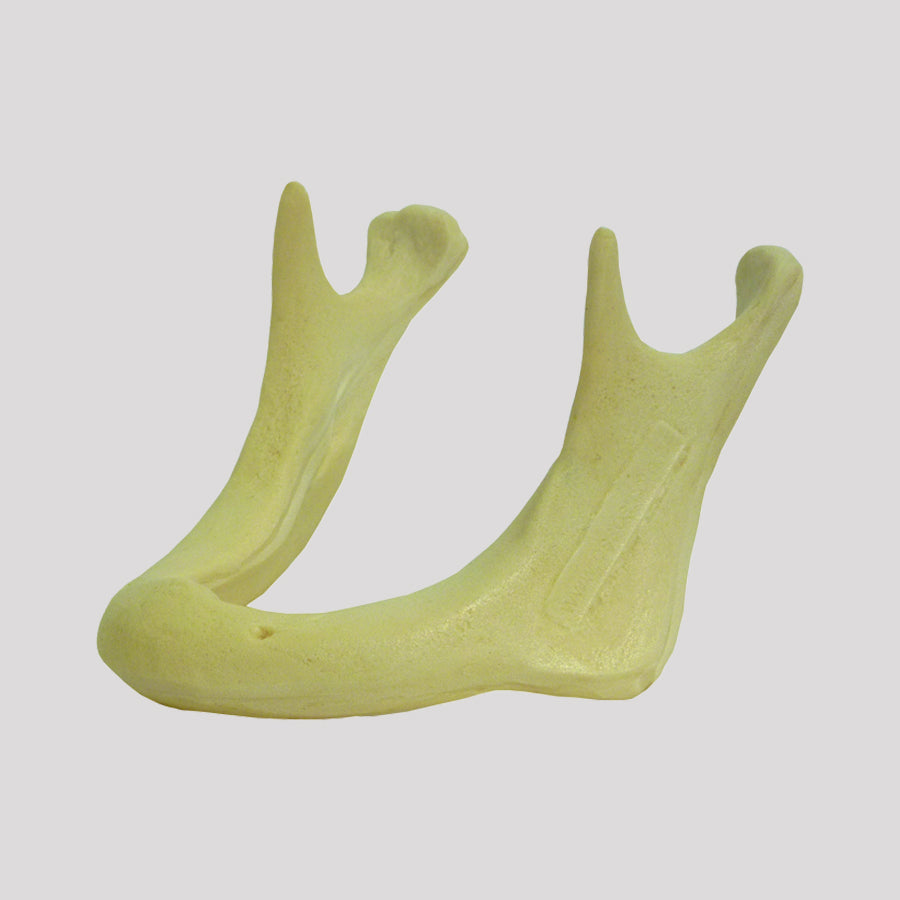 4010 AT - 02B - RADIOPAQUE ATROPHIC EDENTULOUS MANDIBLE CLASS 2 (15MM)