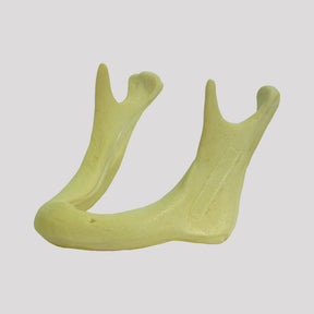 4010AT-02 - ATROPHIC EDENTULOUS MANDIBLE CLASS 2 (15MM)