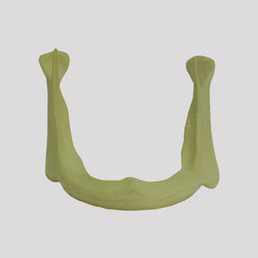 4010 AT - 04 - ATROPHIC EDENTULOUS MANDIBLE CLASS 4 (06MM)