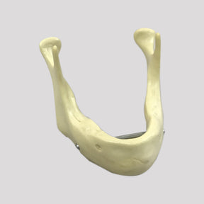 4010B - EDENTULA JAW WITH SUPPORT BAR