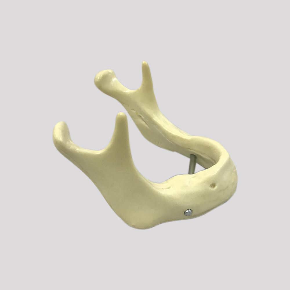 4010B - EDENTULA JAW WITH SUPPORT BAR