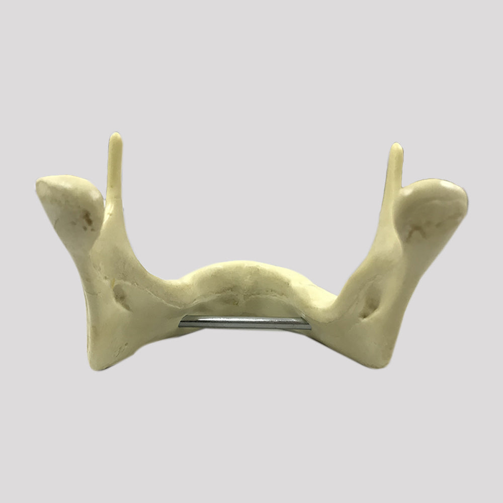 4010B - EDENTULA JAW WITH SUPPORT BAR