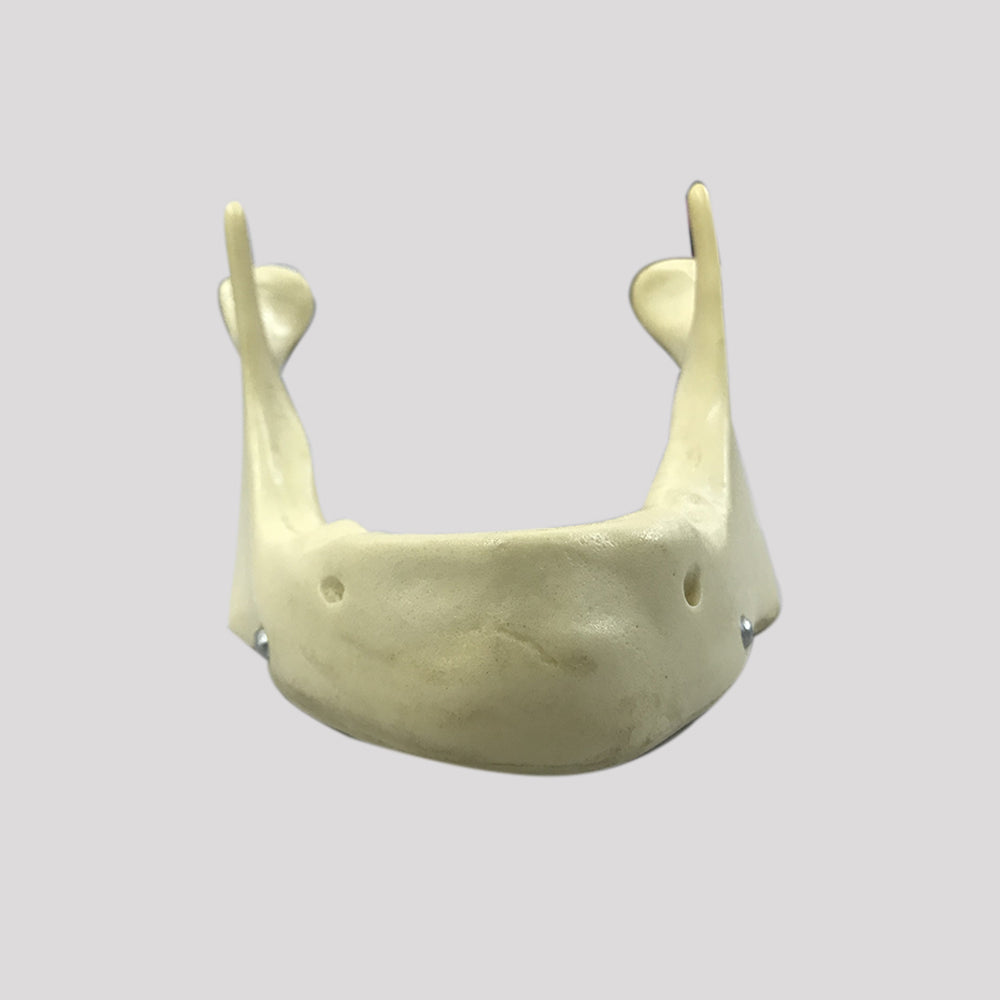 4010B - EDENTULA JAW WITH SUPPORT BAR