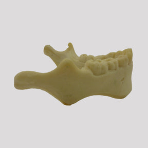 4013 - 2 - CHILD JAW WITH ALL THE TEETH AND DEFORMITY