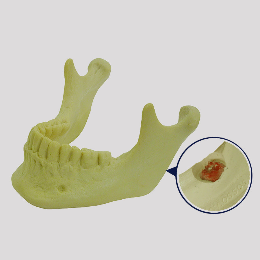 12283 - RADIOPAQUE MANDIBLE WITH ALL TEETH