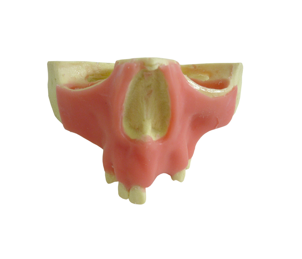 4015GT - MAXILLA WITH SOME TEETH AND GUM