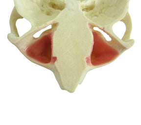 4015T - MAXILLA WITH SOME TEETH