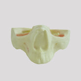 12301 - RADIOPAQUE EDENTULOUS MAXILLA