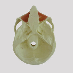 4017T - EDENTULOUS MAXILLA