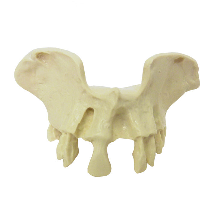 4030 - SMALL MAXILLA WITH SOME TEETH