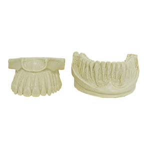 4033 - ORTHODONTIC MODEL WITH EXPOSED ROOT