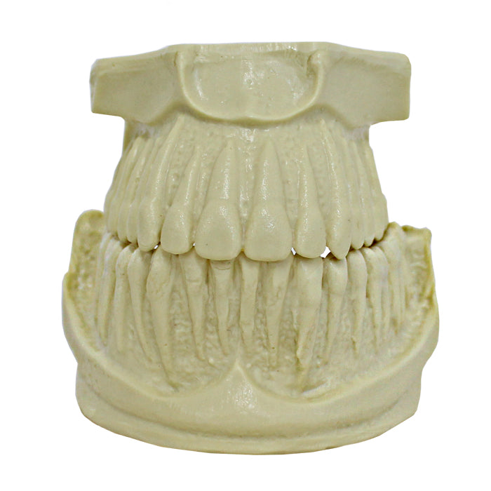 4033 - ORTHODONTIC MODEL WITH EXPOSED ROOT