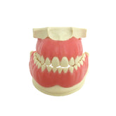 4033G - ORTHODONTHIC MODEL WITH EXPOSED ROOT AND GUM