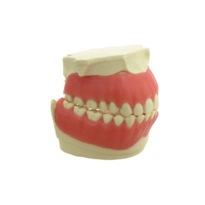 4033G - ORTHODONTHIC MODEL WITH EXPOSED ROOT AND GUM