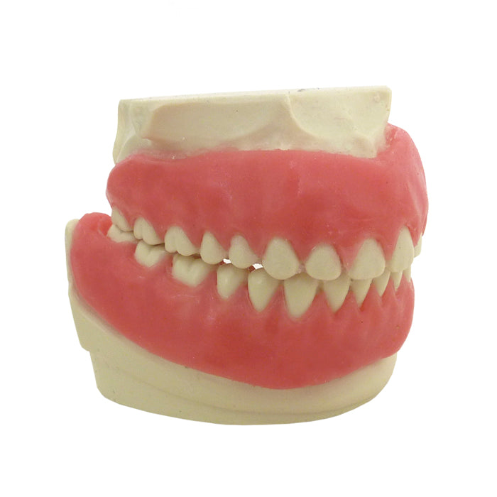 4035 - ORTHODONTIC MODEL WITH GUM