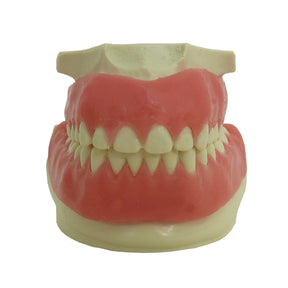 4035 - ORTHODONTIC MODEL WITH GUM