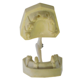 4048 - ARTICULATED MODEL WITH MISSING TEETH (4802/4701)