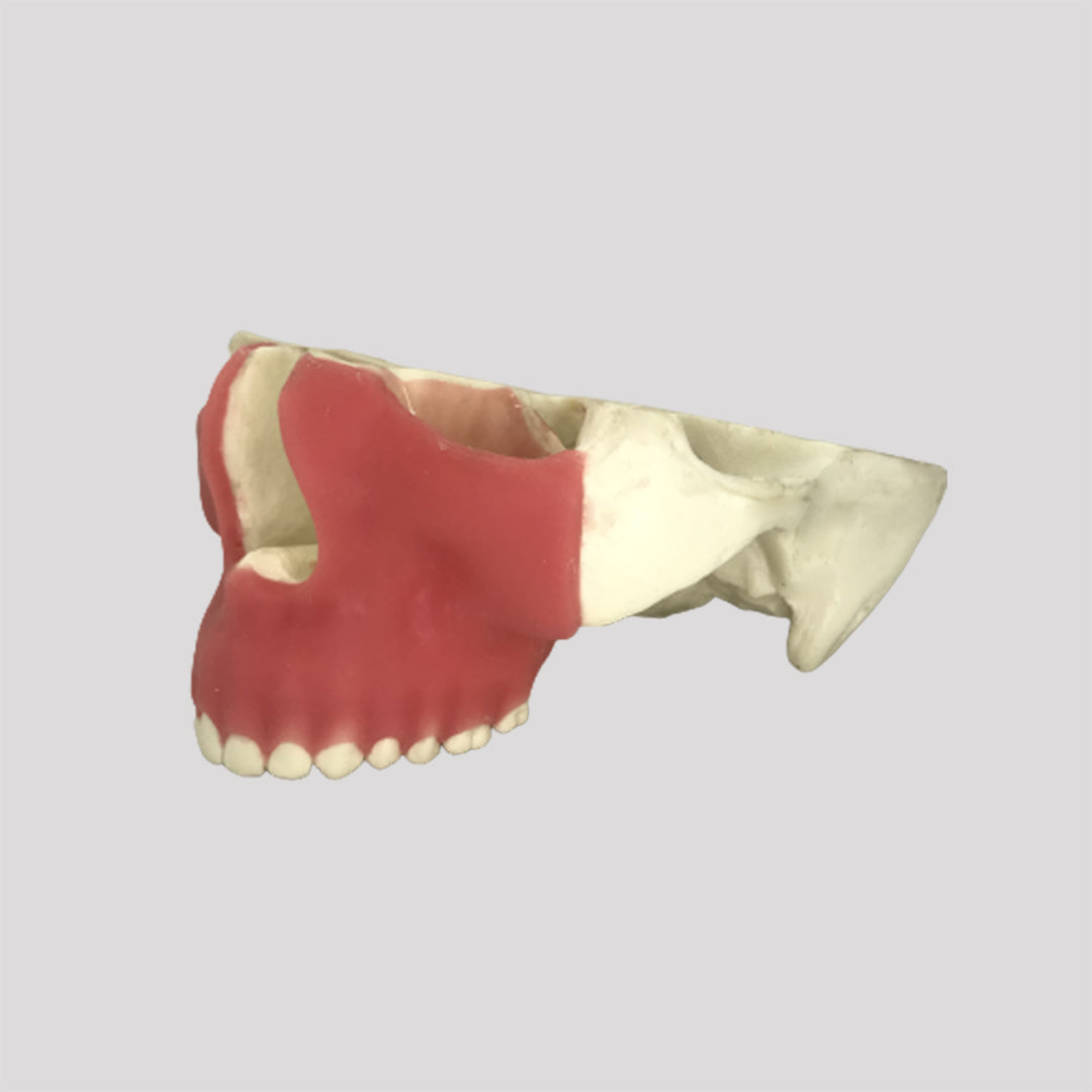 4050 GT - JAW FOR GINGIVECTOMY 2