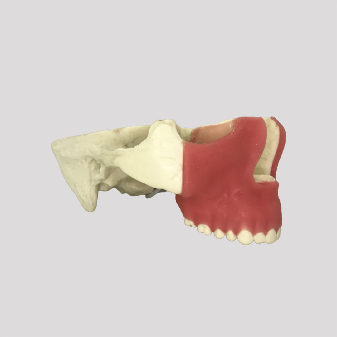 4050 GT - JAW FOR GINGIVECTOMY 2