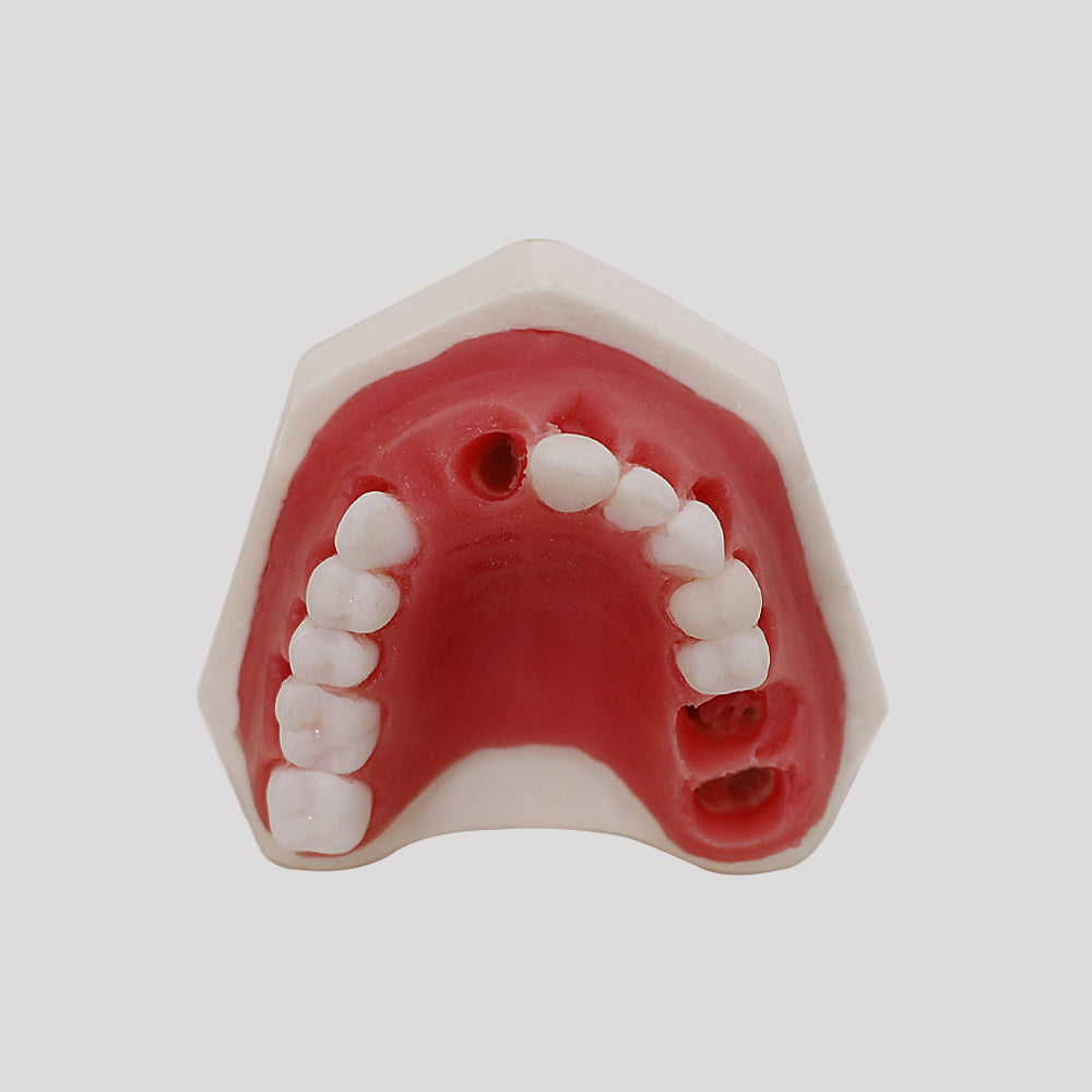 4054 - MAXILLA FOR PERIODONTOLOGY