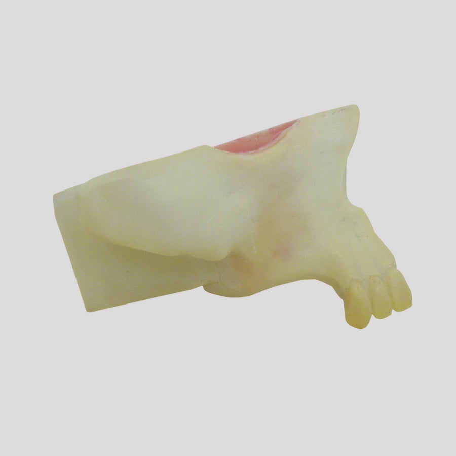 4055-BA - MAXILLARY SINUS WITH SUPPORT BLOCK