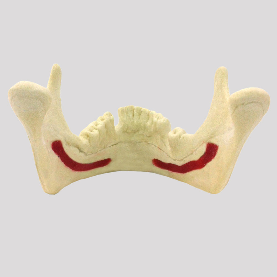 12282 - RADIOPAQUE JAW WITH NERVE AND ABSENCE TEETH 33 AND 46