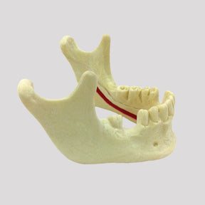 12282 - RADIOPAQUE JAW WITH NERVE AND ABSENCE TEETH 33 AND 46