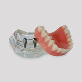 4215 A - ACRYLIC MAXILLA WITH CLIP BAR AND PROSTHESIS