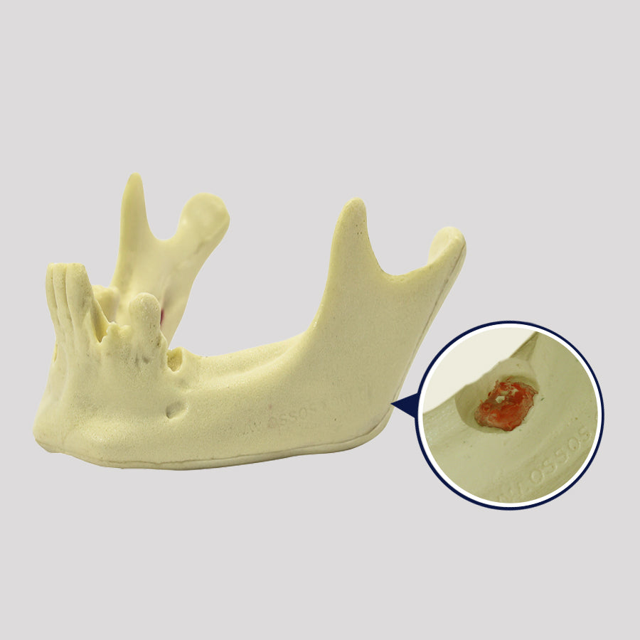 4401 - 02 - JAW WITH 3rd MOLAR INCLUDED