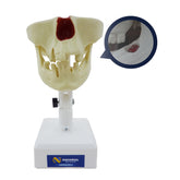 4401 - PREMOLAR MODEL WITH ENCLOSED 3RD MOLAR