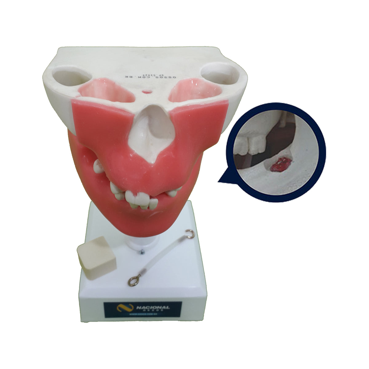 4401G - PREMOLAR MODEL WITH ENCLOSED 3RD MOLAR AND GUM