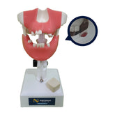 4401G - PREMOLAR MODEL WITH ENCLOSED 3RD MOLAR AND GUM