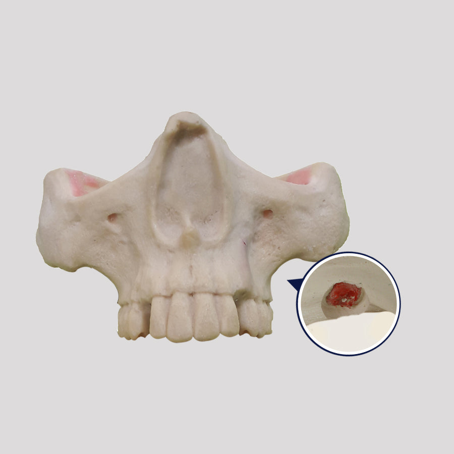 4402 - 01 T - MAXILLA WITH CANINE + 3rd MOLAR INCLUDED