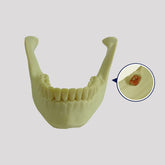 12277 - RADIOPAQUE JAW WITH 3rd MOLAR INCLUDED