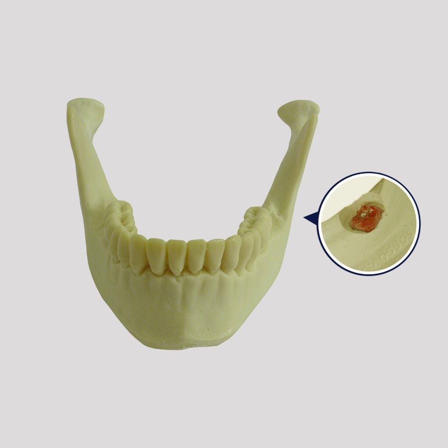 4402 - 02 T - JAW WITH TOOTH 38 INCLUDED