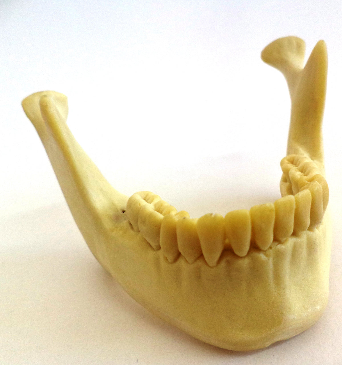 12289 - RADIOPAQUE PRE MOLAR MODEL WITH 3RD MOLAR ENCLOSED AND GUM